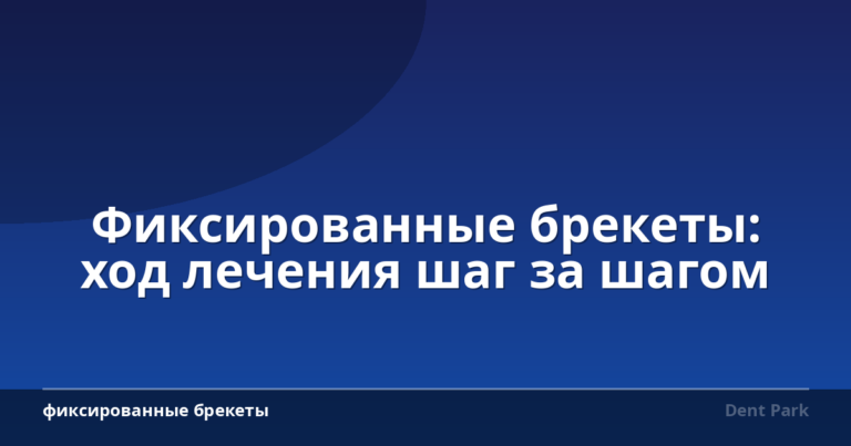 Фиксированные брекеты: ход лечения шаг за шагом