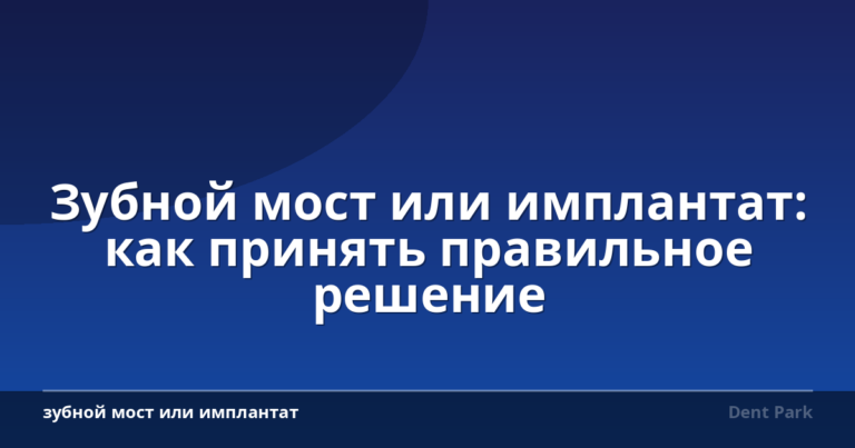 Зубной мост или имплантат: как принять правильное решение