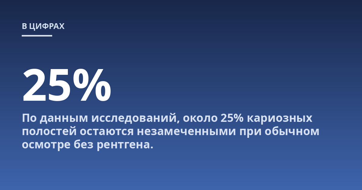По данным исследований, около 25% кариозных полостей остаются незамеченными при обычном осмотре без рентгена.