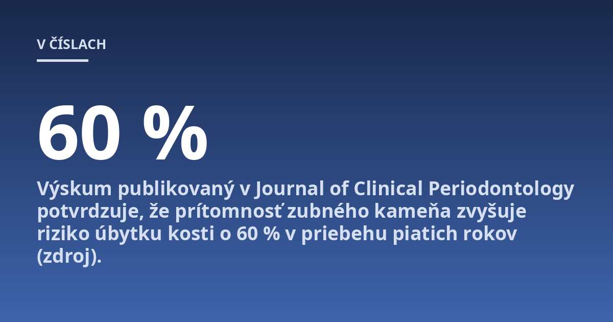 Výskum publikovaný v Journal of Clinical Periodontology potvrdzuje, že prítomnosť zubného kameňa zvyšuje riziko úbytku kosti o 60 % v priebehu piatich rokov (zdroj).